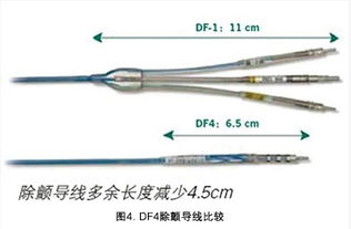 华伟团队成功完成国内首台DF4三合一除颤接口的ICD植入术——365医学导管系列报道